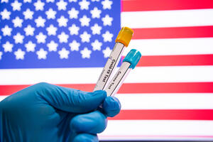 SAD ukida obavezu vakcine protiv kovida za međunarodne putnike