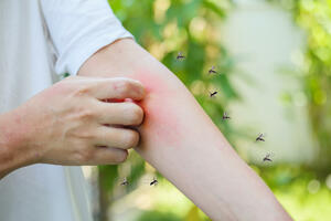 Pokušajte ovaj domaći i prirodni trik za tjeranje komaraca