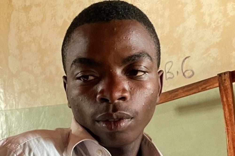 Džulijus Isingoma je čudom preživio, Foto: BBC