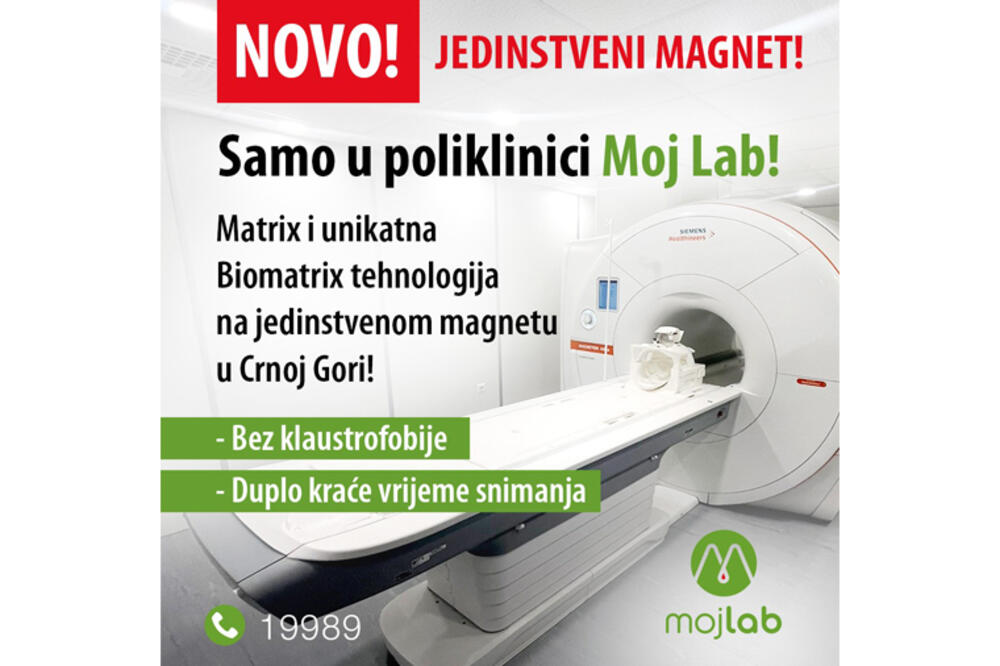 Foto: Moj Lab