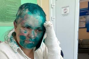 Pretučena ruska novinarka prebačena u moskovsku bolnicu