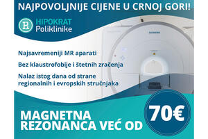 Hipokrat poliklinike: magnetna rezonanca već od 70 EUR