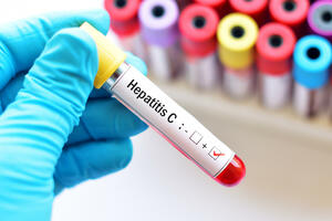 Rano otkrivanje i liječenje hepatitisa produžava život