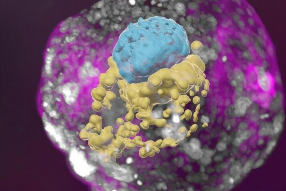 Model prikazuje embrion (plavo), omotač (žuto) i placentu (ljubičasto), Foto: WEIZMANN INSTITUTE OF SCIENCE