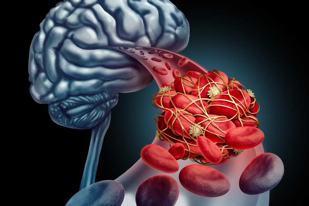 Ilustracija, Foto: Shutterstock