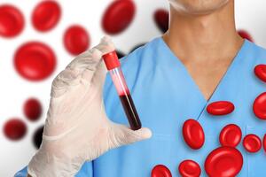 Ne zanemarujte anemiju: Može izazvati ozbiljne probleme