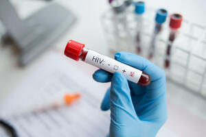 HIV confirmed in another 46 people