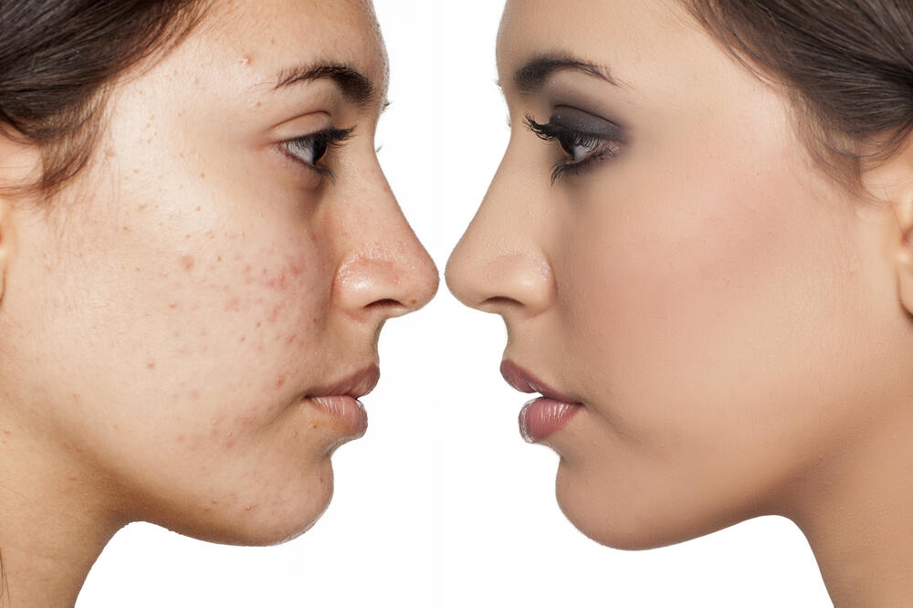 Ilustracija, Foto: Shutterstock