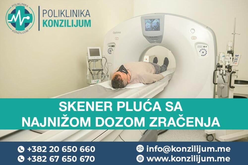 Poliklinika Konzilijum