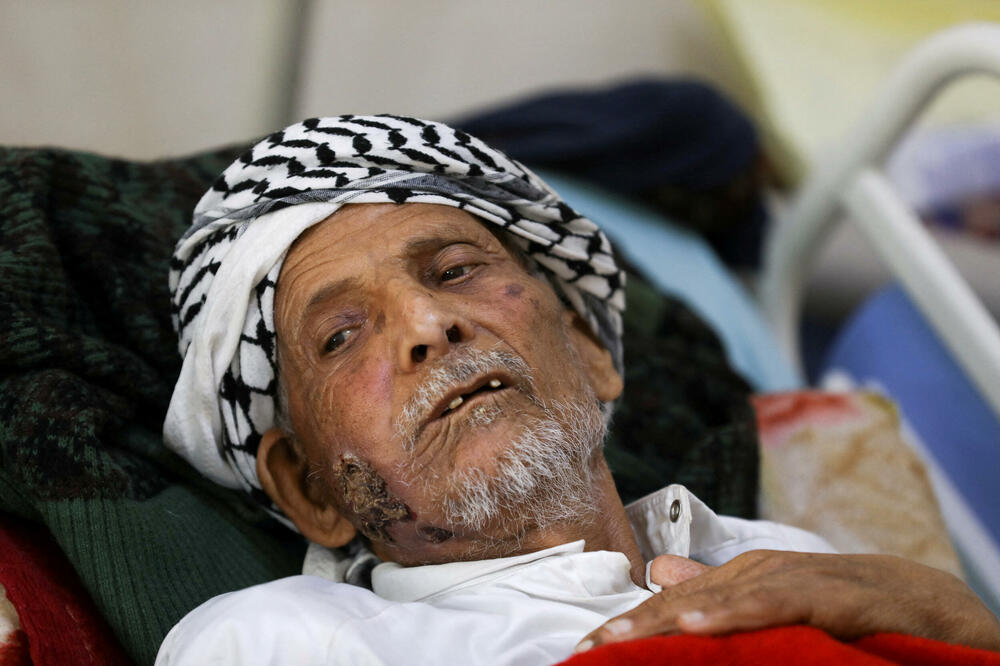 Pacijent koji boluje od raka leži na krevetu u Nacionalnom onkološkom centru u Sani u Jemenu, Foto: reuters