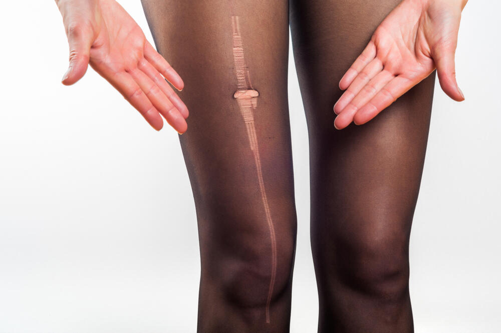 Ilustracija, Foto: Shutterstock