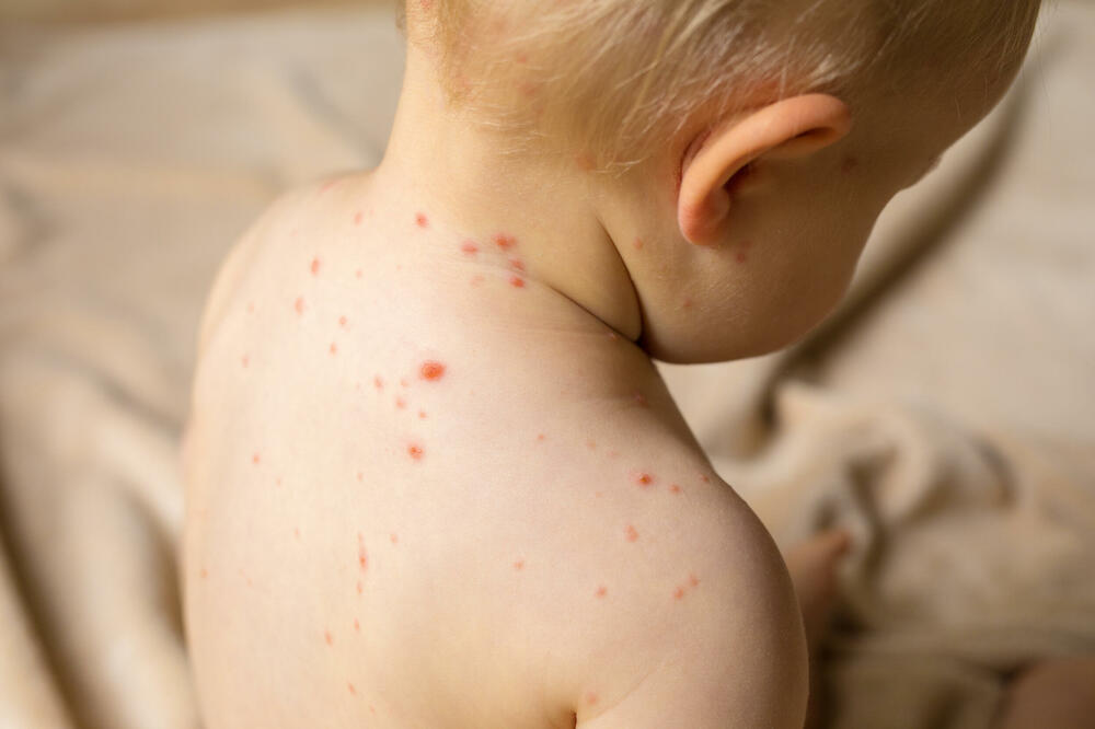 Vakcinisano svega 20 odsto beba rođenih 2022., Foto: Shutterstock