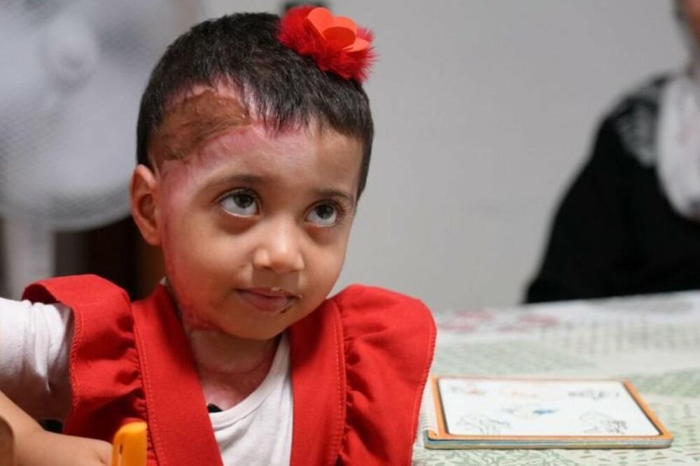 Zeina is one of several thousand injured residents of Gaza who were recently evacuated for treatment abroad, Photo: BBC