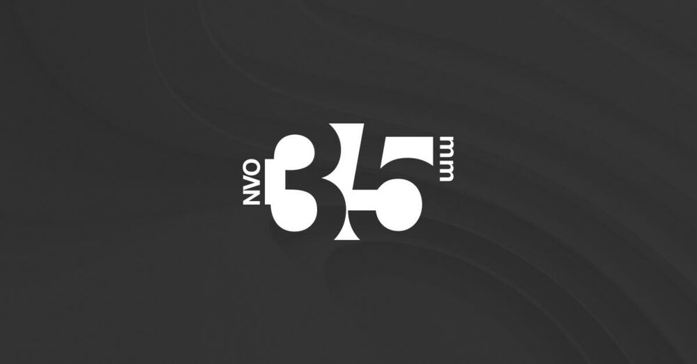 35mm: Podrška Jeleni Jovanović, nadležne instituci