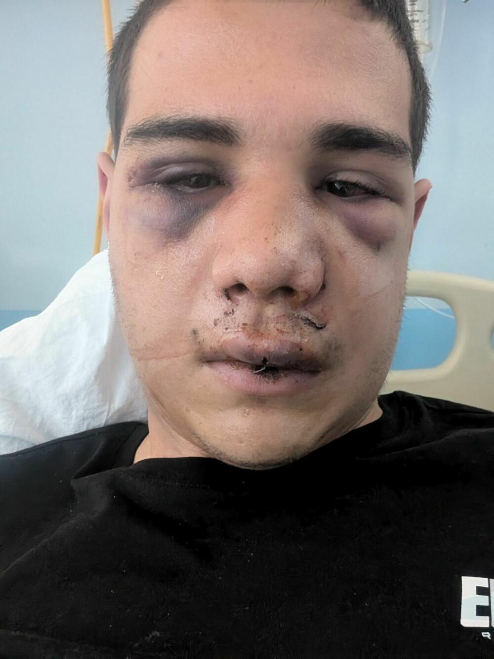 Pretučeni državljanin Francuske u Kliničkom centru