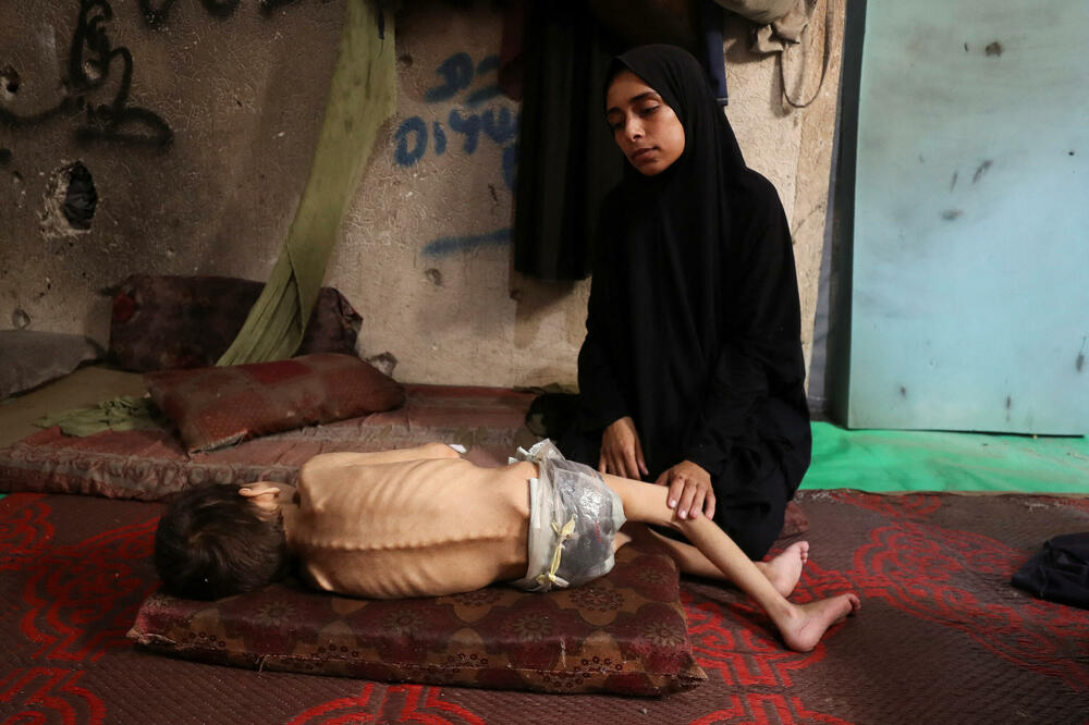 Majka sjedi pored svog neuhranjenog sina, Foto: Reuters