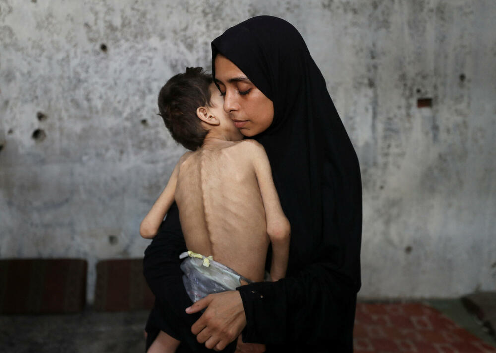 UNICEF: V Gazi alarmantno narašča število umrlih otrok zaradi podhranjenosti