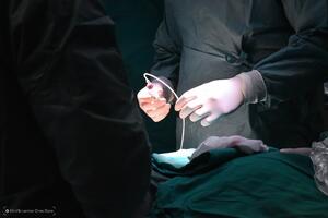 Hemoport do sada ugrađen kod 36 pacijenata