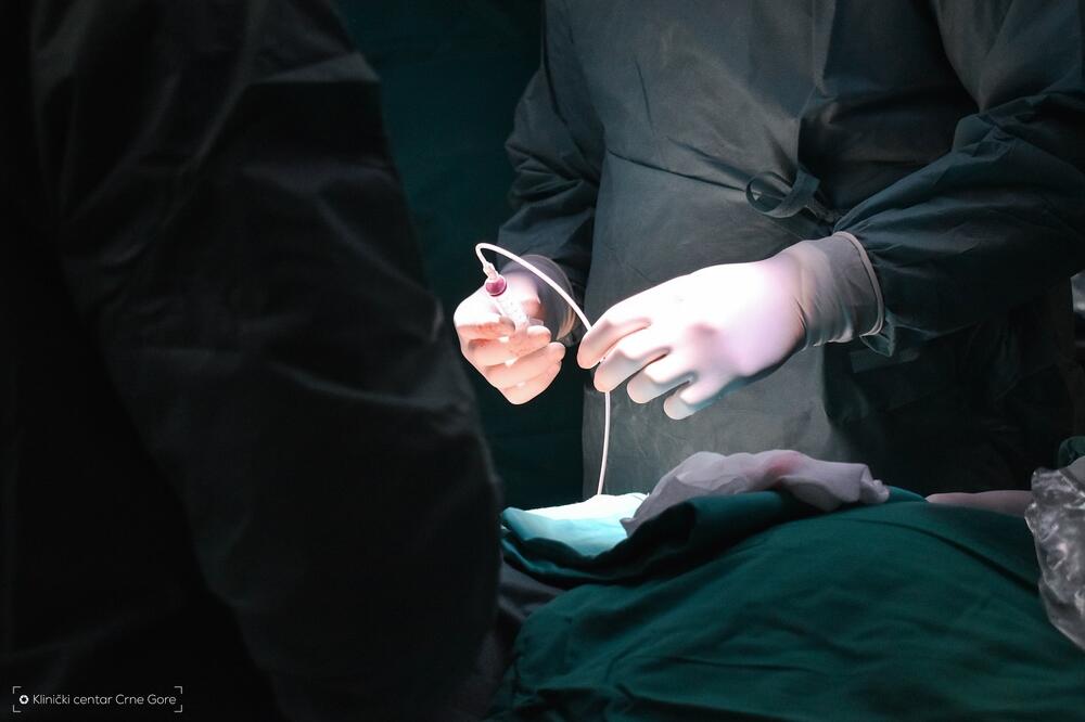 Procedura prvi put urađena krajem 2024. godine, Foto: KCCG