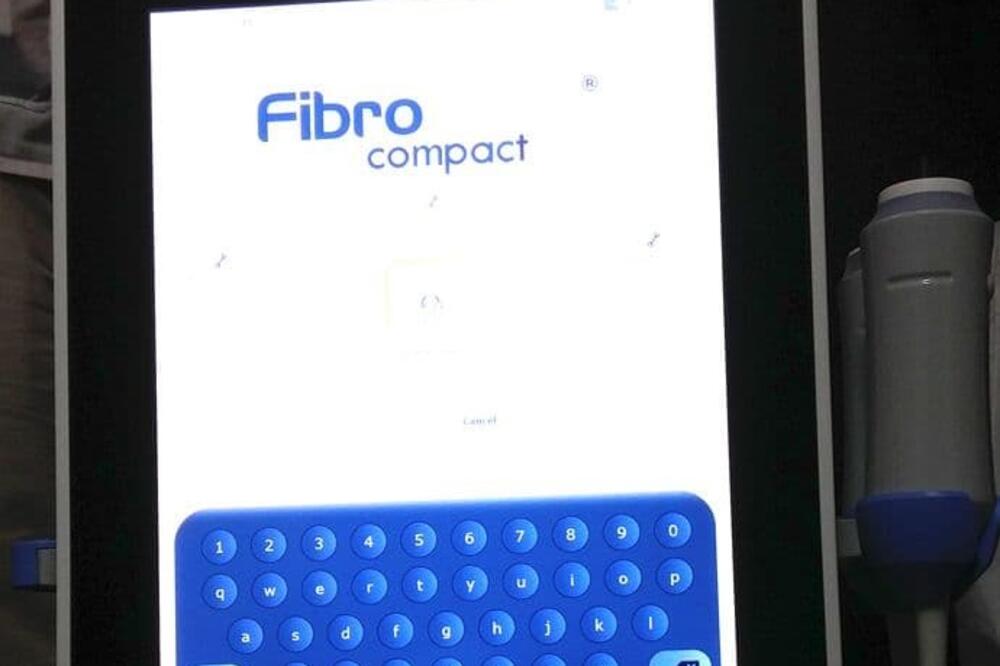 Aparat doniran KCCG-u prije osam godina, Foto: KCCG