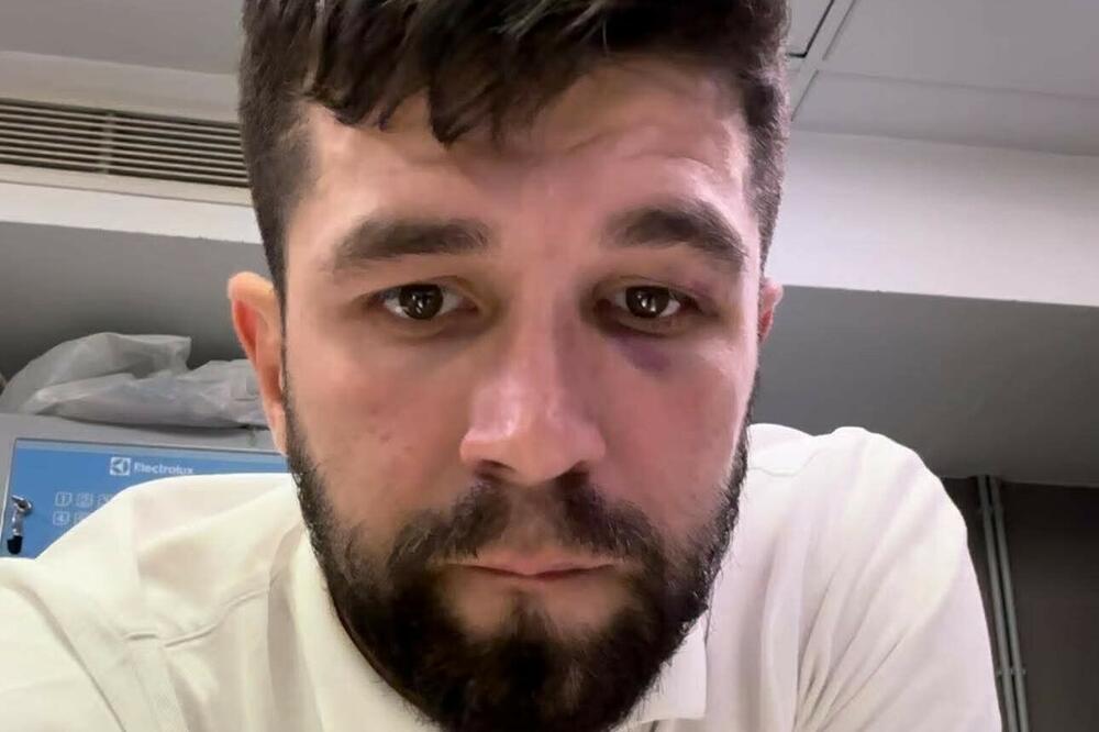 V.B. nakon što je pretučen u hotelu, tvrdi njegova porodica, Foto: Privatna arhiva