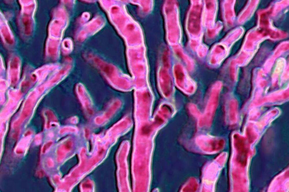 Foto: BSIP/Education Images/Universal Images Group/Getty Images