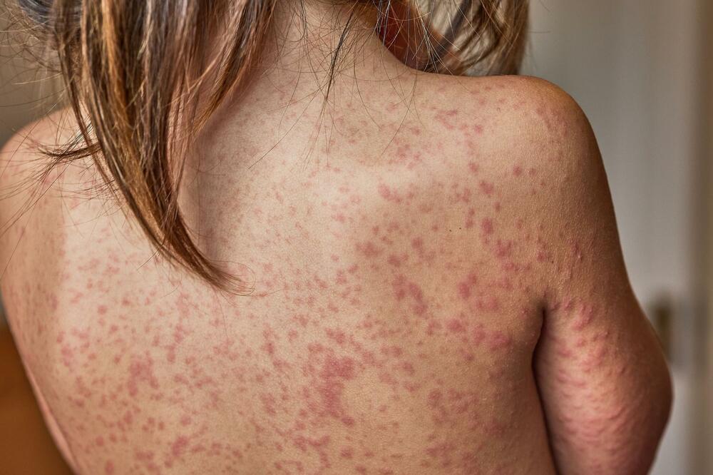 Ilustracija, Foto: Shutterstock