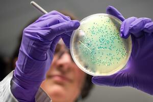 Vještačka inteligencija pronašla antibiotike za gonoreju i MRSA...