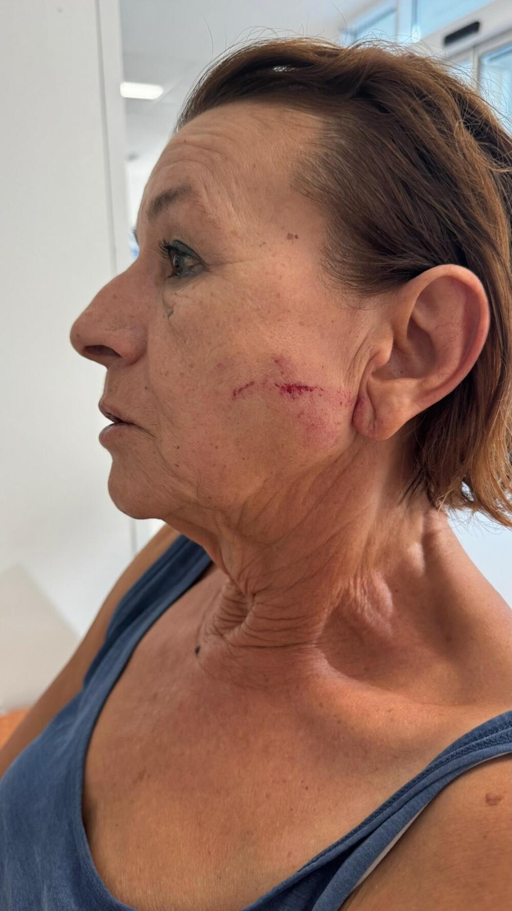 <p>Branka i Kristina Marović dostavile su fotografije povreda koje su zadobile te navele da godinama unazad trpe da ih Parezanović maltretira, jer ne žele da dozvole da im neko uzirpira njihovu imovinu</p>  <p>Parezanović je danas naveo ga je napao Nikola Marović dok je bio sa ženom i dvogodišnjim djetetom</p>  <p> </p>