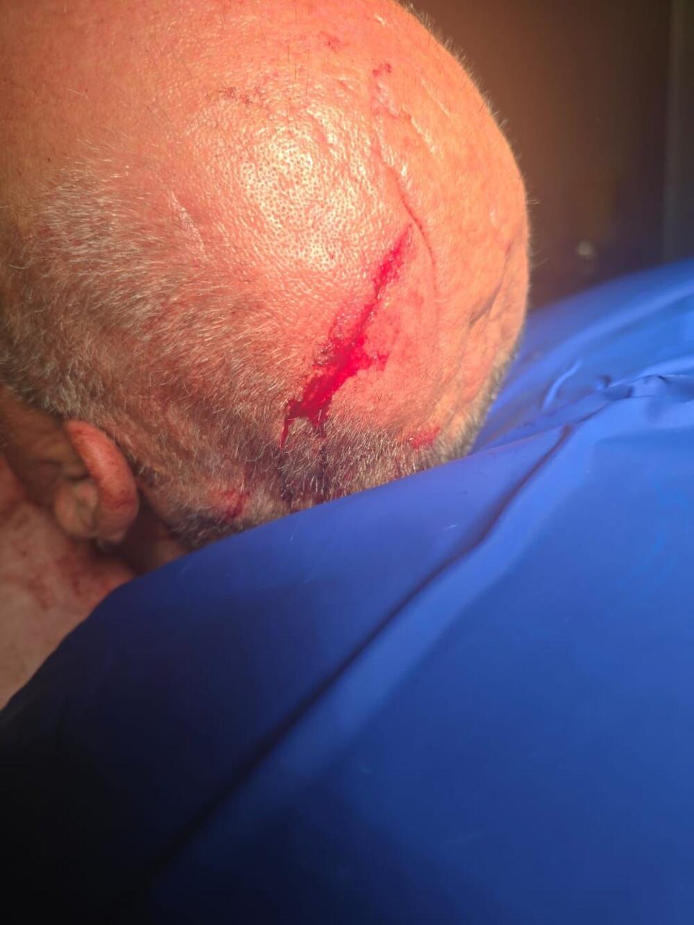 Marović nakon napada