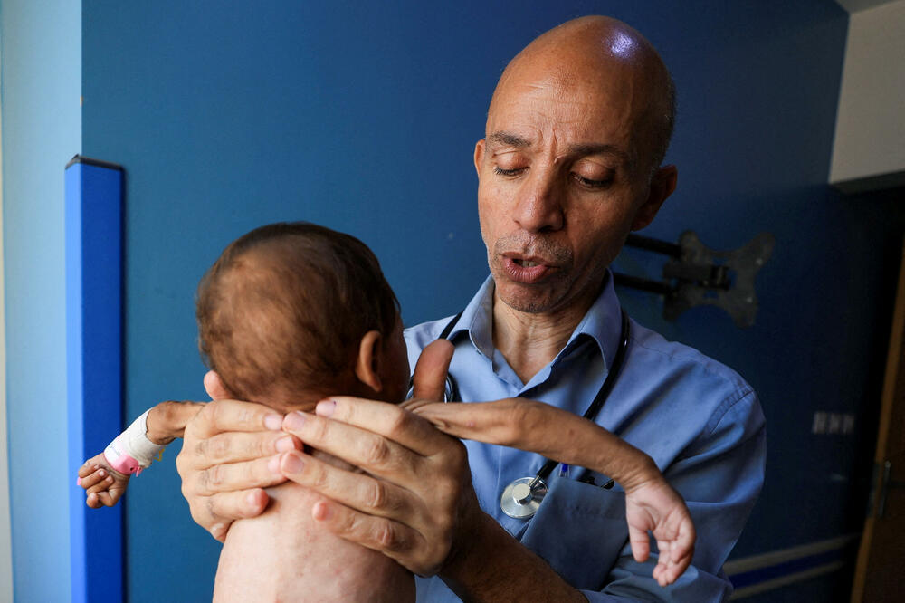 Doktor Ahmed Basal pregleda dijete koje pati od neuhranjenosti u bolnici u Gazi 7. avgusta, Foto: Rojters