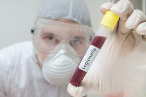 Legionarska bolest i u Crnoj Gori: Kod jednog pacijenta u KCCG...