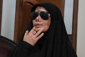 Žrtva izraelskog napada pejdžerima u Libanu: "Moje oči su nestale"