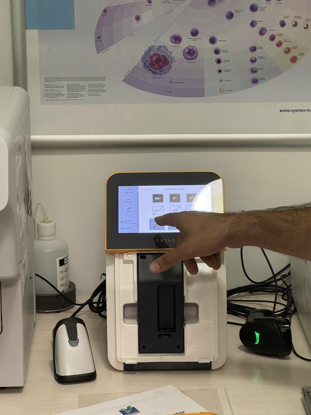 <p>Nabavljen je i aparat za određivanje vrijednosti elektrolita za jedinicu hitne pomoći u Podgorici</p>