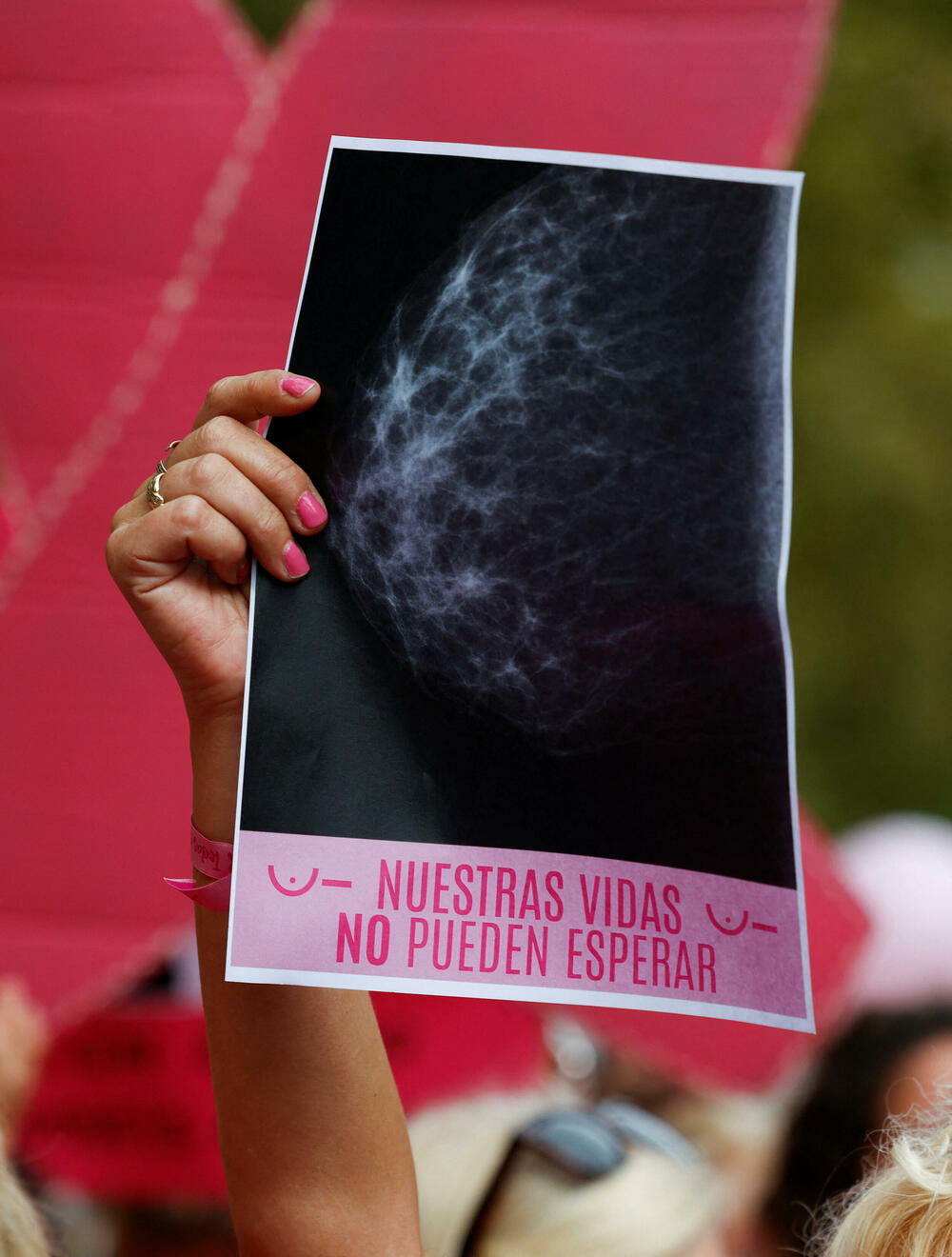 <p>Vlasti u južnom regionu Andaluzije, predvođene desničarskom opozicionom Narodnom strankom, navele su da najmanje 2.300 žena posljednjih godina nije obaviješteno o rezultatima svojih mamografa urađenih u javnim bolnicama, posebno u Sevilji</p>