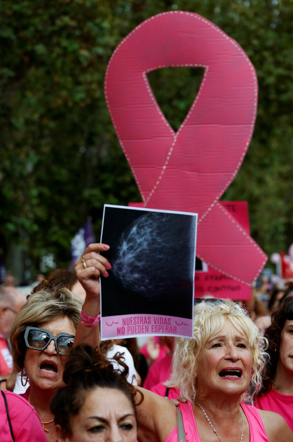 <p>Vlasti u južnom regionu Andaluzije, predvođene desničarskom opozicionom Narodnom strankom, navele su da najmanje 2.300 žena posljednjih godina nije obaviješteno o rezultatima svojih mamografa urađenih u javnim bolnicama, posebno u Sevilji</p>