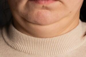 Šta obim vrata govori o vašem zdravlju