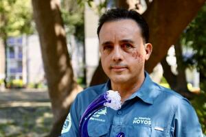 Čovjek kom je ajkula poštedjela život