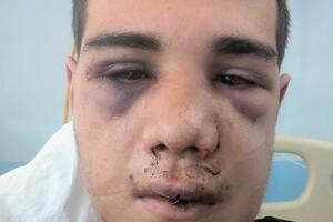 Pretučeni stranac još čeka na pravdu: Nema krivih za brutalno...