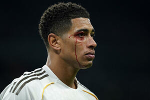 U Realu ogorčeni: Belingem dobio udarac u glavu, a Iglesijas...