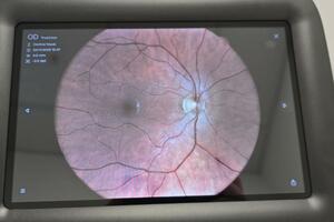 Ministarstvo zdravlja pokreće pilot-projekat za bržu i dostupniju...