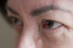 Doktori ćutali o lijeku koji izaziva 'rizične' seksualne nagone...