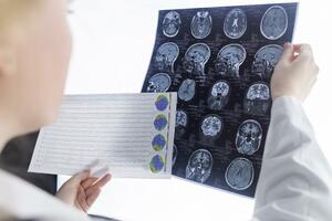 Smrt Svetislava Miloševića nastala od udarca u glavu?