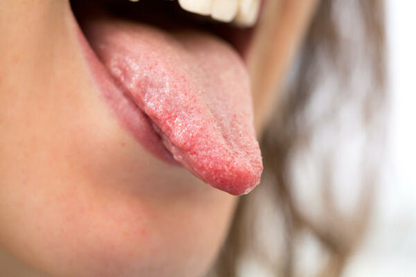 Общество неудачливых теннисистов