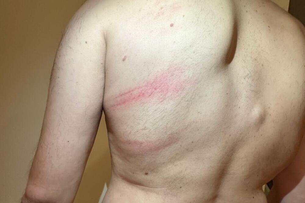 Podgoričanin: Policajci me pretukli, vrijeđali me i ponižavali,...