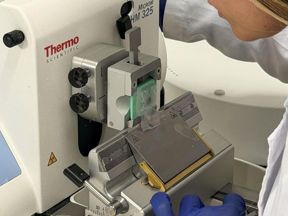 <p>Naučnici iz Grupe za tkivni inženjering univerziteta i biomedicinskog istraživačkog instituta Granada saopštili su da su napravili implantate za rožnjaču od ribljih krljušti koji su pokazali visoku biokompatibilnost, providnost i otpornost</p>