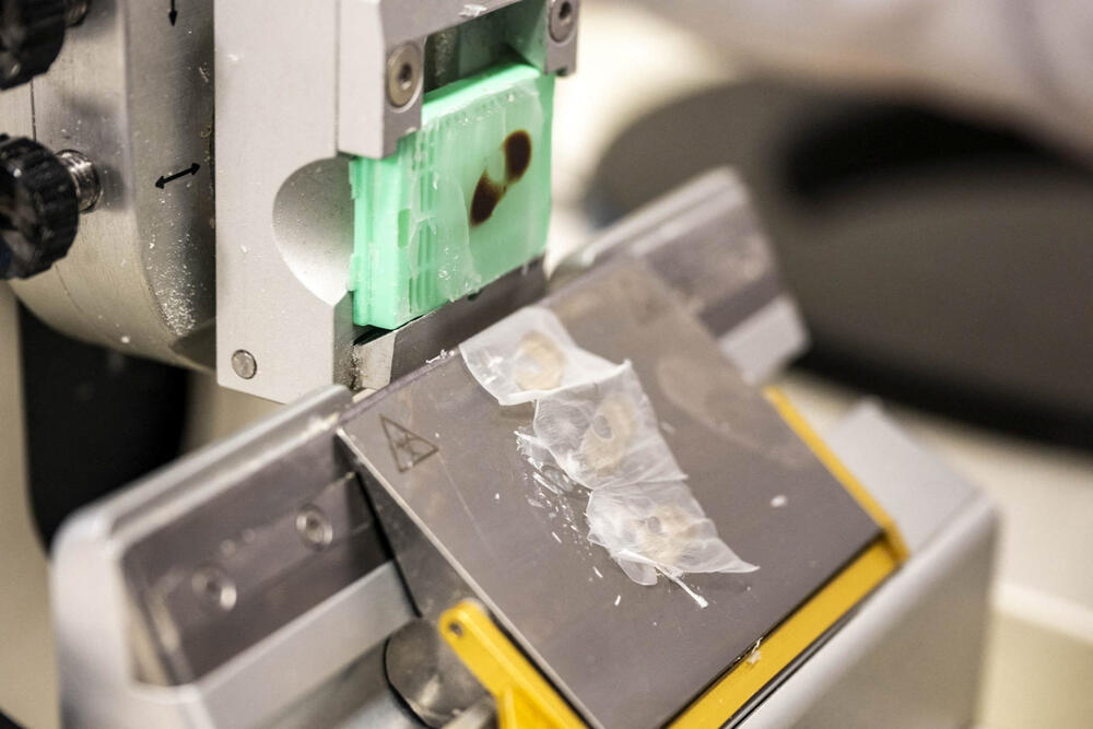 <p>Naučnici iz Grupe za tkivni inženjering univerziteta i biomedicinskog istraživačkog instituta Granada saopštili su da su napravili implantate za rožnjaču od ribljih krljušti koji su pokazali visoku biokompatibilnost, providnost i otpornost</p>