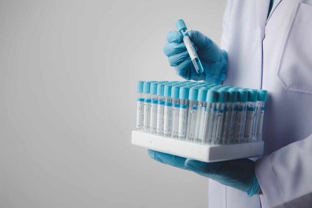 Sportske igre na kojima se "varanje" podstiče