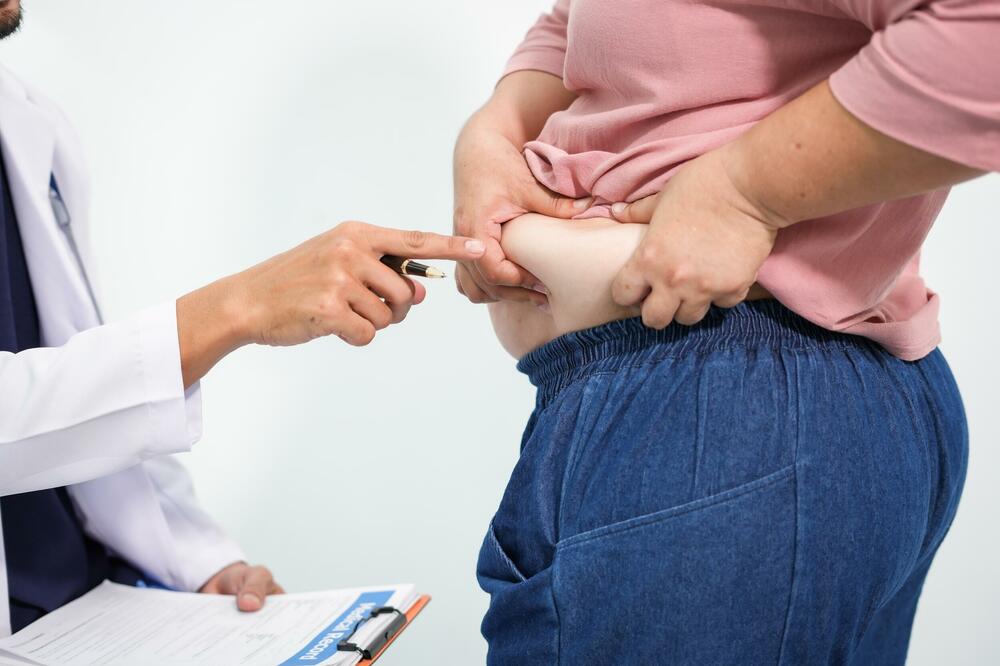 Gojaznost veoma zastupljena u Crnoj Gori, Foto: Shutterstock