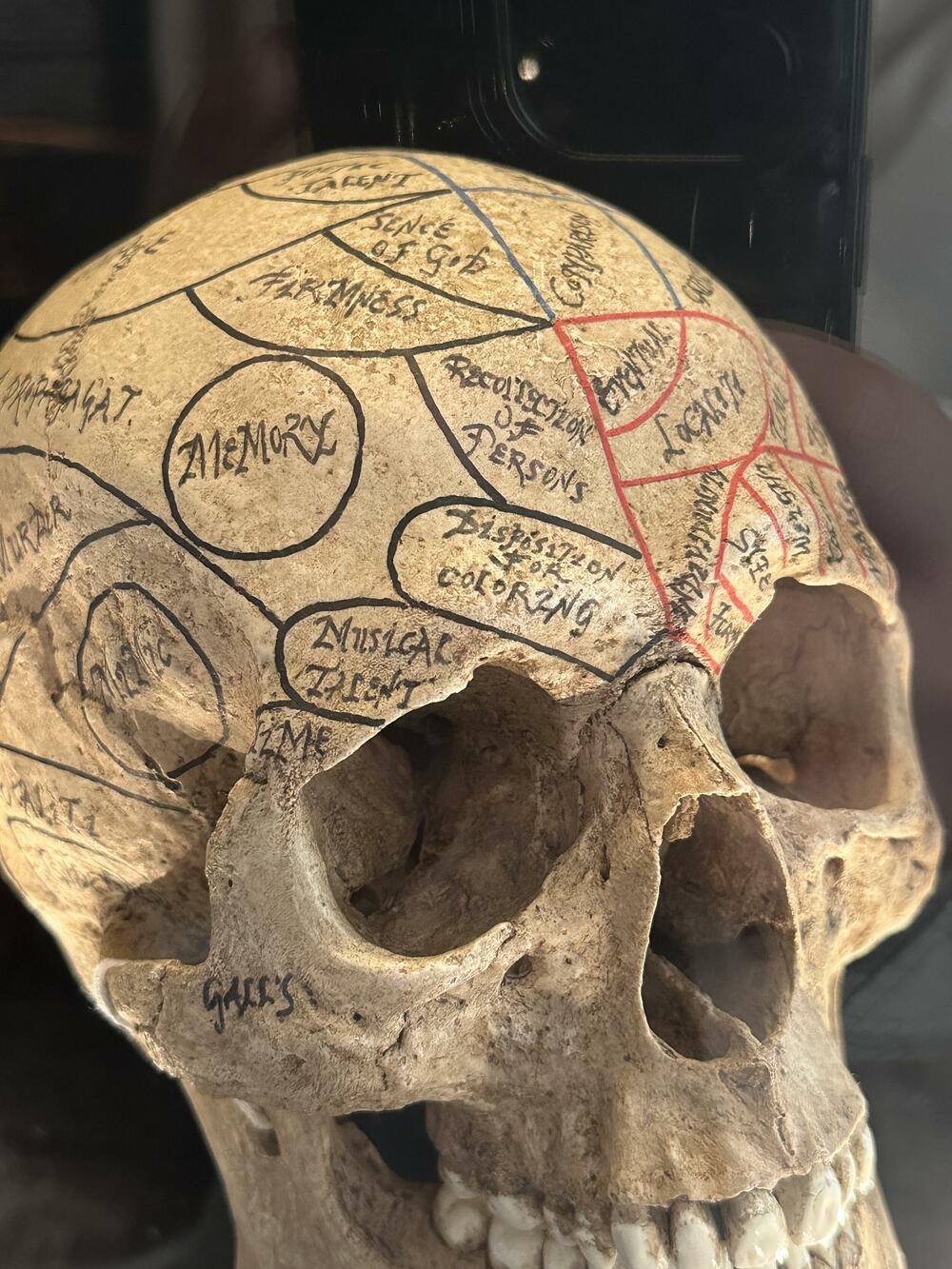 Iz Muzeja istorije medicine u Padovi